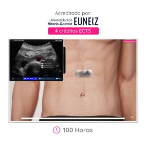 Ecografía Abdominal