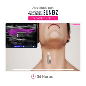 Ecografía de Cuello y Tiroides