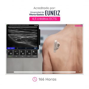 Ecografía Musculoesquelética