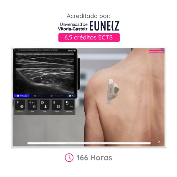Ecografía Musculoesquelética