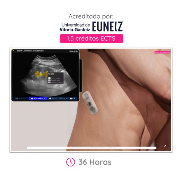Ecografía Urológica