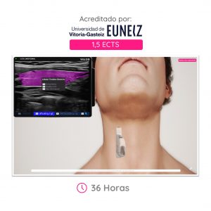 Ecografía de Cuello y Tiroides