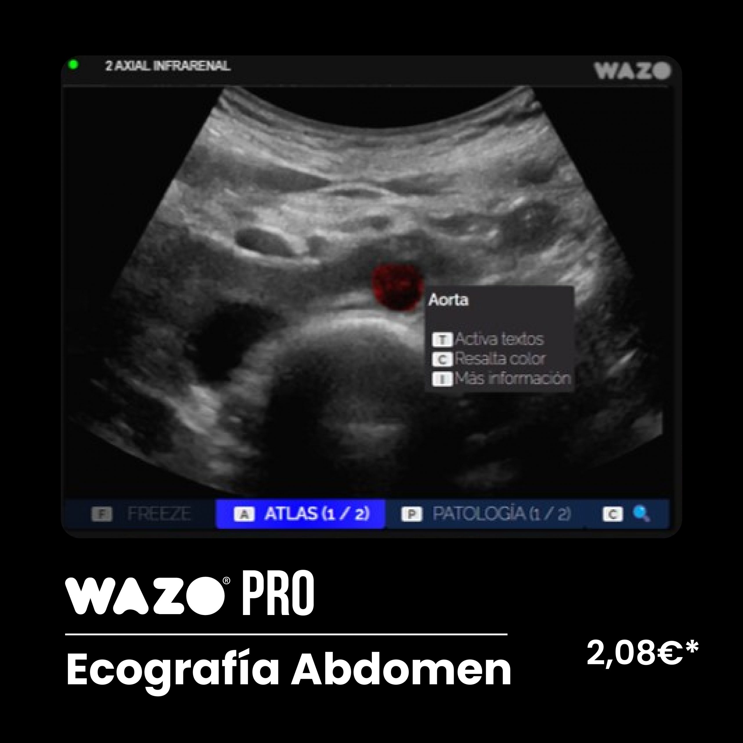 WAZO PRO – Abdomen