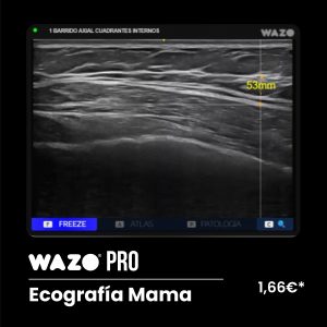 WAZO PRO – Mama