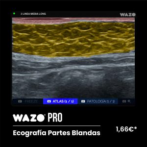 WAZO PRO – Partes Blandas