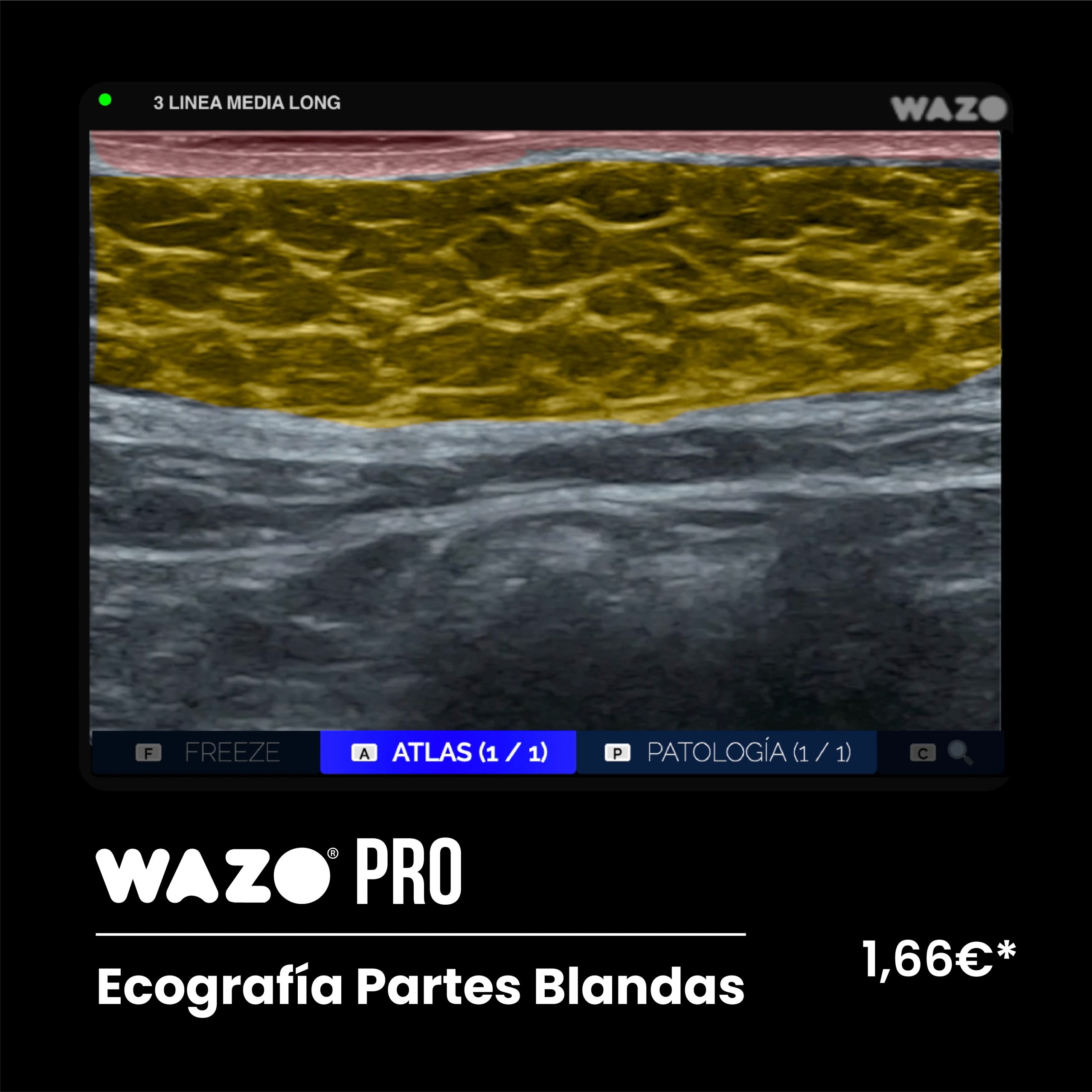 WAZO PRO – Partes Blandas