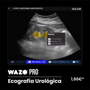 WAZO PRO – Urológica